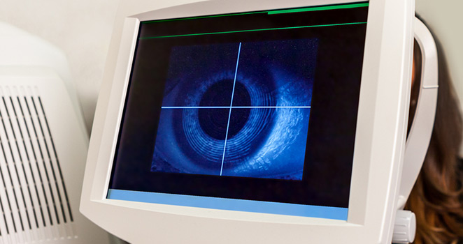 Monitor displaying an enlarged image of an eye