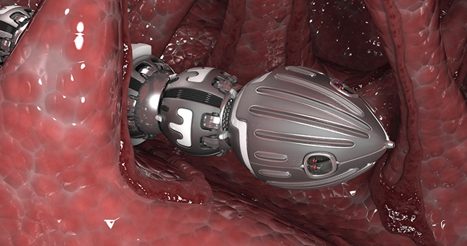 Ilustration of a tiny robotic probe moving through patients body