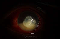 Upclose image of a corneal infection
