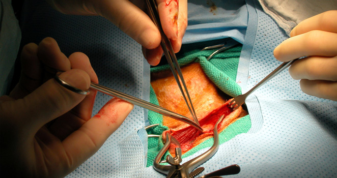 Open peripheral vascular surgery in progress