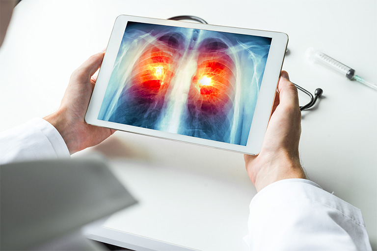 Doctor looking at a lung screening on a tablet