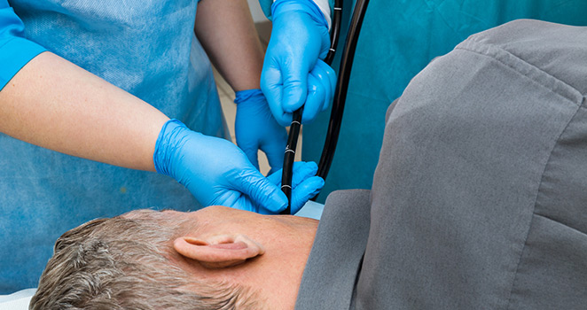 Man undergoing an upper endoscopy