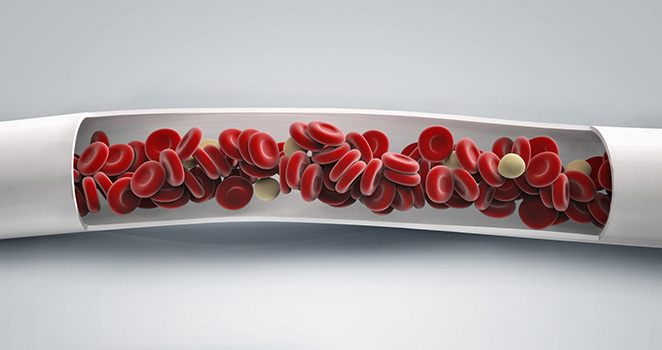 Illustration of blood moving through a blood vessel