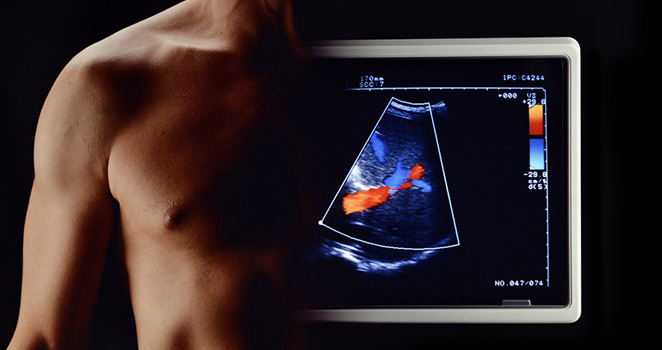 a young man's chest and shoulder and a monitor reading of a Video-Assisted Thoracoscopic surgery 