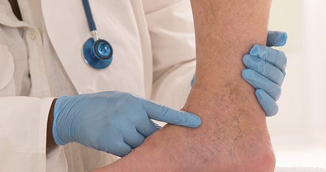 Doctor pointing out vein on a patients ankle